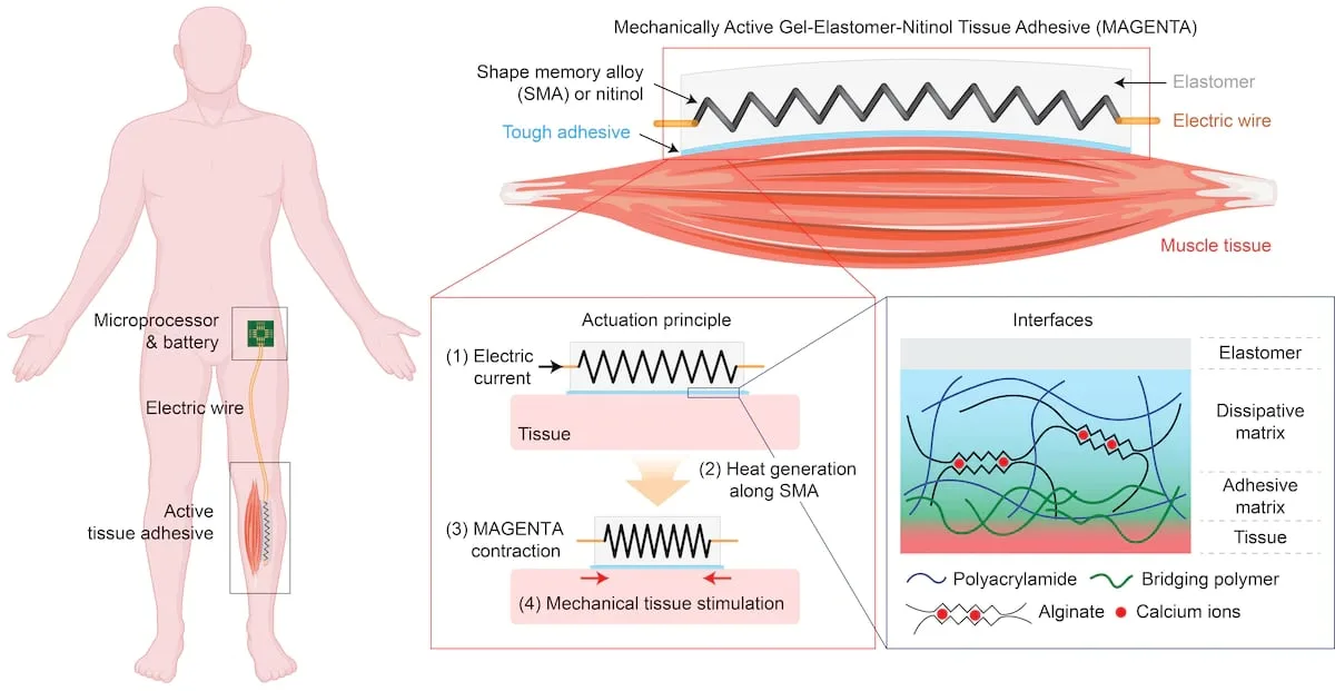 Illustration that zooms in from the patient's body (far left) to the material's composition and interactions with muscle tissue (lower right)