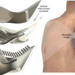 Wearable ultrasound patch could offer real-time heart scans on the go