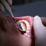 Gum disease: causes, risks, prevention and when to see your dentist